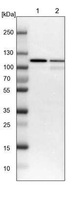 Western Blot Isopeptidase T/USP5 Antibody - BSA Free