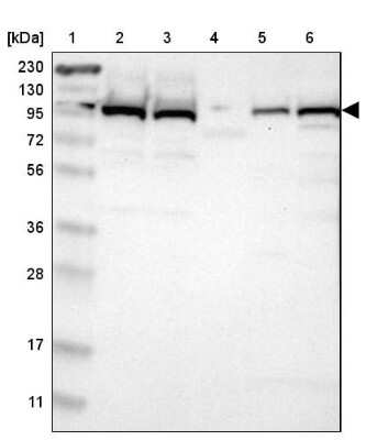 Western Blot: Isopeptidase T/USP5 Antibody [NBP1-83089] - Lane 1: Marker  [kDa] 230, 130, 95, 72, 56, 36, 28, 17, 11.  Lane 2: Human cell line RT-4.  Lane 3: Human cell line U-251MG sp.  Lane 4: Human plasma (IgG/HSA depleted).  Lane 5: Human liver tissue.  Lane 6: Human tonsil tissue