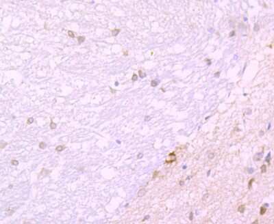 Immunohistochemistry-Paraffin: JAB1 Antibody (JB34-96) [NBP2-75546] - Analysis of paraffin-embedded rat brain tissue using anti-JAB1 antibody. Counter stained with hematoxylin.