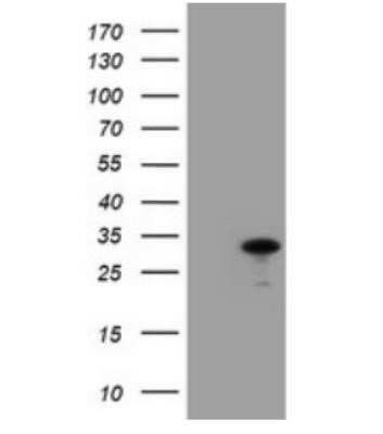 Western Blot: JAB1 Antibody (OTI2B12) - Azide and BSA Free [NBP2-71659] - HEK293T cells were transfected with the pCMV6- ENTRY control (Left lane) or pCMV6-ENTRY COPS5 (RC200979, Right lane) cDNA for 48 hrs and lysed. Equivalent amounts of cell lysates (5 ug per lane) were separated by SDS-PAGE and immunoblotted with anti COPS