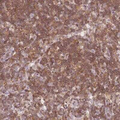 Immunohistochemistry-Paraffin: JAKMIP1 Antibody [NBP2-14137] - Staining of human lymph node shows moderate cytoplasmic positivity in non-germinal center cells.