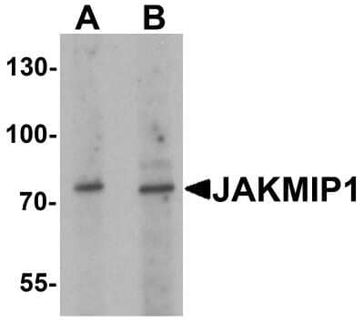 Western Blot: JAKMIP1 Antibody [NBP2-81959] - Western blot analysis of JAKMIP1 in rat brain tissue lysate with JAKMIP1 antibody at (A) 1 and (B) 2 ug/mL