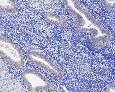 Immunohistochemistry-Paraffin: JAM-A Antibody (SC60-07) [NBP2-67636] - Analysis of paraffin-embedded human endometrium tissue using anti-JAM-A antibody. The section was pre-treated using heat mediated antigen retrieval with Tris-EDTA buffer (pH 8.0-8.4) for 20 minutes.The tissues were blocked in 5% BSA for 30 minutes at room temperature, washed with ddH2O and PBS, and then probed with the primary antibody (1/50) for 30 minutes at room temperature. The detection was performed using an HRP conjugated compact polymer system. DAB was used as the chromogen. Tissues were counterstained with hematoxylin and mounted with DPX.