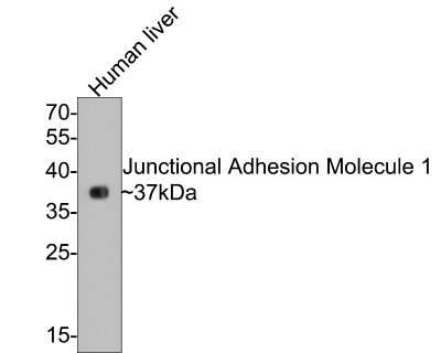 Western Blot: JAM-A Antibody (SC60-07) [NBP2-67636] - Analysis of JAM-A on human liver tissue lysates with Rabbit anti-JAM-A antibody at 1/500 dilution. Lysates/proteins at 20 ug/Lane. Predicted band size: 33 kDa Observed band size: 37 kDa Exposure time: 30 seconds; 12% SDS-PAGE gel. Proteins were transferred to a PVDF membrane and blocked with 5% NFDM/TBST for 1 hour at room temperature. The primary antibody at 1/500 dilution was used in 5% NFDM/TBST at room temperature for 2 hours. Goat Anti-Rabbit IgG - HRP Secondary Antibody at 1:300,000 dilution was used for 1 hour at room temperature.