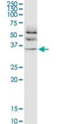 Western Blot: JAM-B/VE-JAM Antibody (1G4) [H00058494-M01] - JAM2 monoclonal antibody (M01), clone 1G4. Analysis of JAM2 expression in HL-60.