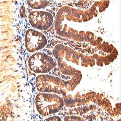 Immunohistochemistry-Paraffin: JAM-B/VE-JAM Antibody [NBP1-32655] - Paraffin-embedded mouse small intestine, using antibody at 1:200 dilution. Image courtesy of Koji Taniguchi, Ph. D (Laboratory of Dr. Michael Karin, UCSD).