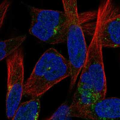 Immunocytochemistry/Immunofluorescence: JAM-C Antibody [NBP2-58727] - Staining of human cell line RH-30 shows localization to the Golgi apparatus.