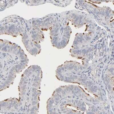 Immunohistochemistry-Paraffin: JAM-C Antibody [NBP1-92032] - Staining of human Fallopian tube shows strong positivity in cilia in glandular cells.