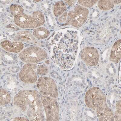 Immunohistochemistry-Paraffin: JAM-C Antibody [NBP1-92032] - Staining of human kidney shows moderate cytoplasmic positivity in cells in tubules.