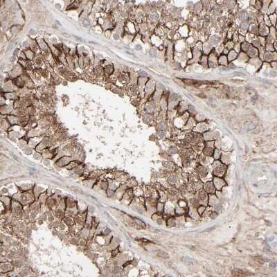 Immunohistochemistry-Paraffin: JAM-C Antibody [NBP1-92032] - Staining of human testis shows strong membranous positivity in cells in seminiferous ducts.