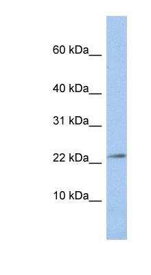 Western Blot: JAM-C Antibody [NBP1-60096] - HepG2 cell lysate, concentration 0.2-1 ug/ml.