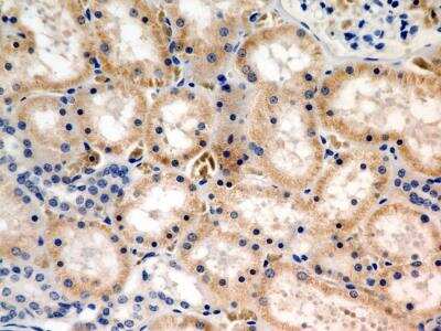 Immunohistochemistry-Paraffin: JAMP Antibody [NBP2-36446] - IHC analysis of formalin-fixed paraffin-embedded tissue section of human normal kidney using rabbit polyclonal JAMP antibody (NBP2-36446) at 10 ug/ml concentration. The cells of various tubules/ducts showed a weak to moderate cytoplasmic immunopositivity for JAMP protein.