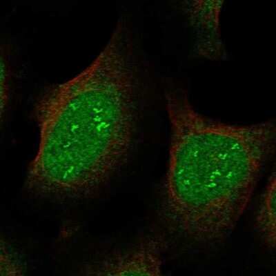 Immunocytochemistry/Immunofluorescence: JAZF1 Antibody [NBP2-57403] - Staining of human cell line U-2 OS shows localization to nucleus & nucleoli fibrillar center. Antibody staining is shown in green.