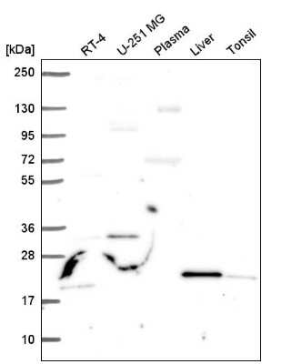 Western Blot: JAZF1 Antibody [NBP2-57403] - Analysis in human cell line RT-4, human cell line U-251 MG, human plasma, human liver tissue and human tonsil tissue.