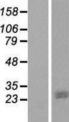 Western Blot: JAZF1 Overexpression Lysate (Adult Normal) [NBP2-05075] Left-Empty vector transfected control cell lysate (HEK293 cell lysate); Right -Over-expression Lysate for JAZF1.