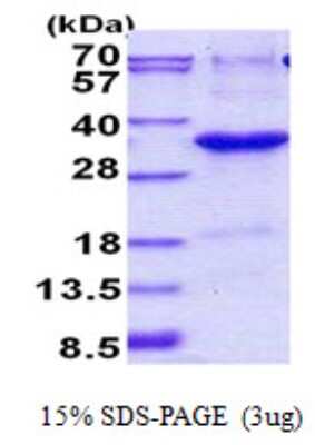 SDS-PAGE Recombinant Human JAZF1 His Protein