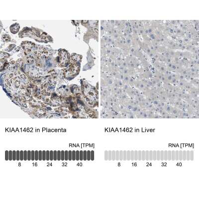 Immunohistochemistry-Paraffin: JCAD Antibody [NBP1-90941] - Analysis in human placenta and liver tissues using NBP1-90941 antibody. Corresponding KIAA1462 RNA-seq data are presented for the same tissues.