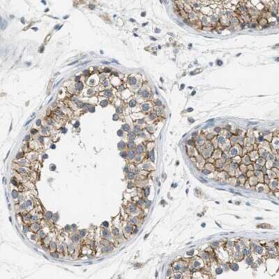 Immunohistochemistry-Paraffin: JCAD Antibody [NBP1-90941] - Staining of human testis shows moderate membranous positivity in cells in seminiferous ducts.