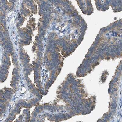 Immunohistochemistry-Paraffin: JCAD Antibody [NBP1-90941] - Staining of human Fallopian tube shows moderate positivity in apical membrane in glandular cells.