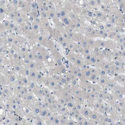 Immunohistochemistry-Paraffin: JCAD Antibody [NBP1-90941] - Staining of human liver shows no positivity in hepatocytes as expected.