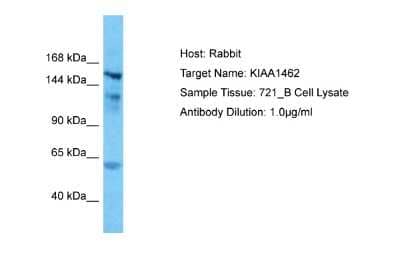 Western Blot: JCAD Antibody [NBP2-83094] - Host: Rabbit. Target Name: KIAA1462. Sample Type: 721_B Whole Cell lysates. Antibody Dilution: 1.0ug/ml