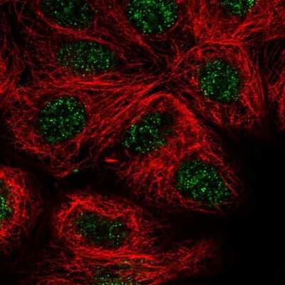 Immunocytochemistry/ Immunofluorescence JDP2 Antibody