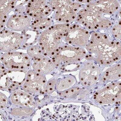 Immunohistochemistry-Paraffin: JDP2 Antibody [NBP2-31775] - Staining of human kidney shows strong nuclear positivity in cells in tubules.