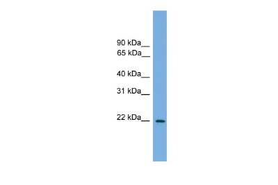 Western Blot JDP2 Antibody