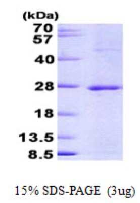 SDS-PAGE Recombinant Human JDP2 His Protein