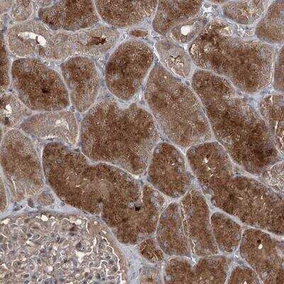 Immunohistochemistry: JIP2 Antibody [NBP1-89638] - Staining of human kidney shows distinct cytoplasmic positivity in tubule cells.