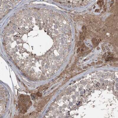 Immunohistochemistry-Paraffin: JIP2 Antibody [NBP1-89638] - Staining of human Testis shows moderate cytoplasmic positivity in Leydig cells and cells in seminiferous ducts.