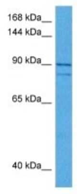 Western Blot: JIP2 Antibody [NBP3-10078] - Western blot analysis of JIP2 in Human Leiomyosarcoma Tumor lysates. Antibody dilution at 1ug/ml