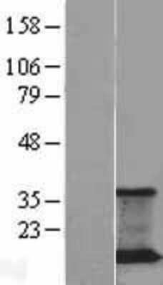 Western Blot JM4 Overexpression Lysate