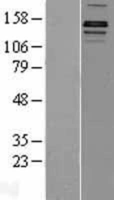 Western Blot: JMJD1A Overexpression Lysate (Adult Normal) [NBP2-11469] Left-Empty vector transfected control cell lysate (HEK293 cell lysate); Right -Over-expression Lysate for JMJD1A.