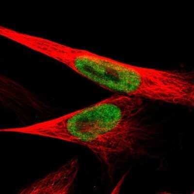 Immunocytochemistry/ Immunofluorescence JMJD1B Antibody - BSA Free