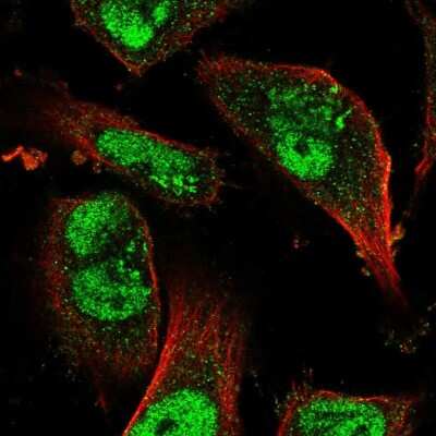 Immunocytochemistry/Immunofluorescence: JMJD1B Antibody [NBP2-58143] - Staining of human cell line U-251 MG shows localization to nucleoplasm & the Golgi apparatus.