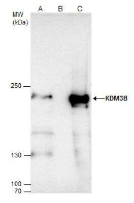 Immunoprecipitation: JMJD1B Antibody [NBP2-17007] - IP samples: NT2D1 whole cell extract A. 50 ug NT2D1 whole cell extract B. Control with 4 ug of preimmune Rabbit IgG C. Immunoprecipitation of KDM3B protein by 4 ug KDM3B antibody [C2C3], C-term 5 % SDS-PAGE