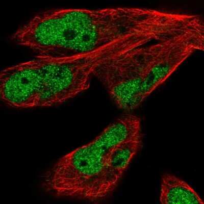 Immunocytochemistry/Immunofluorescence: JMJD1C Antibody [NBP2-55700] - Staining of human cell line RH-30 shows localization to nucleoplasm.