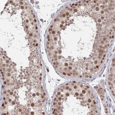 Immunohistochemistry-Paraffin: JMJD1C Antibody [NBP2-33777] - Staining of human testis shows moderate nuclear positivity in cells in seminiferous duct.