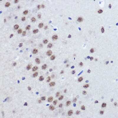 Immunohistochemistry-Paraffin: JMJD1C Antibody [NBP3-15959] - Immunohistochemistry of paraffin-embedded rat brain using JMJD1C Rabbit pAb (NBP3-15959) at dilution of 1:100 (40x lens).Perform microwave antigen retrieval with 10 mM PBS buffer pH 7.2 before commencing with IHC staining protocol.