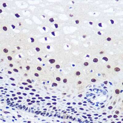 Immunohistochemistry-Paraffin: JMJD1C Antibody [NBP3-15959] - Immunohistochemistry of paraffin-embedded human esophageal using JMJD1C Rabbit pAb (NBP3-15959) at dilution of 1:100 (40x lens).Perform microwave antigen retrieval with 10 mM PBS buffer pH 7.2 before commencing with IHC staining protocol.