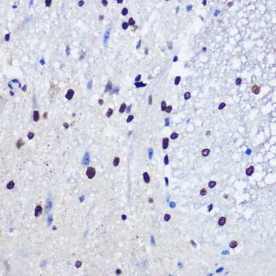 Immunohistochemistry-Paraffin: JMJD1C Antibody [NBP3-15959] - Immunohistochemistry of paraffin-embedded mouse spinal cord using JMJD1C Rabbit pAb (NBP3-15959) at dilution of 1:100 (40x lens).Perform microwave antigen retrieval with 10 mM PBS buffer pH 7.2 before commencing with IHC staining protocol.