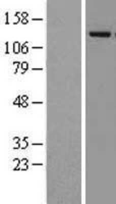 Western Blot: JMJD2A Overexpression Lysate (Adult Normal) [NBL1-12103] Left-Empty vector transfected control cell lysate (HEK293 cell lysate); Right -Over-expression Lysate for JMJD2A.