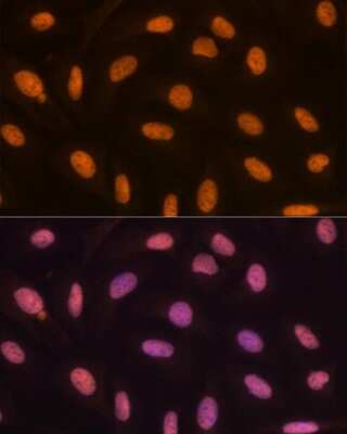 Immunocytochemistry/Immunofluorescence: JMJD2B Antibody (8I0I1) [NBP3-16639] - Immunofluorescence analysis of U-2 OS cells using JMJD2B Rabbit mAb (NBP3-16639) at dilution of 1:100 (40x lens). Blue: DAPI for nuclear staining.