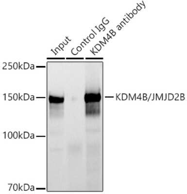 Immunoprecipitation: JMJD2B Antibody (8I0I1) [NBP3-16639] - Immunoprecipitation analysis of 300ug extracts of HCT116 cells using 3ug JMJD2B antibody (NBP3-16639). Western blot was performed from the immunoprecipitate using JMJD2B antibody (NBP3-16639) at a dilition of 1:1000.