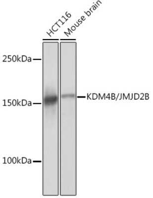 Western Blot JMJD2B Antibody (8I0I1)