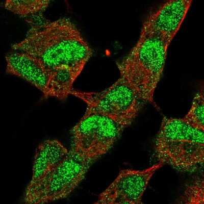 Immunocytochemistry/Immunofluorescence: JMJD2B Antibody [NBP2-56243] - Staining of human cell line SH-SY5Y shows localization to nucleus & cytosol.