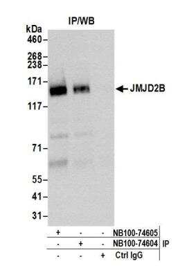 Immunoprecipitation: JMJD2B Antibody [NB100-74604] - Detection of human JMJD2B by western blot of immunoprecipitates. Samples: Whole cell lysate (1.0 mg per IP reaction; 20% of IP loaded) from HeLa cells prepared using NETN lysis buffer. Antibodies: Affinity purified rabbit anti-JMJD2B antibody NB100-74604 used for IP at 3 ug per reaction. JMJD2B was also immunoprecipitated by rabbit anti-JMJD2B antibody NB100-74605. For blotting immunoprecipitated JMJD2B, NB100-74604 was used at 1 ug/ml. Detection: Chemiluminescence with an exposure time of 30 seconds.