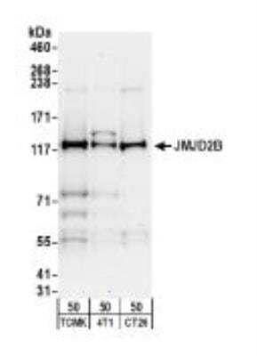 Western Blot: JMJD2B Antibody [NB100-74605] - Whole cell lysate (50 ug) from TCMK-1, 4T1, and CT26.WT cells. Dilution used for WB at 0.5 ug/ml.