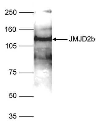 Western Blot: JMJD2B Antibody [NBP2-59196] - Nuclear extracts of HeLa cells (40 ug) were analysed by Western blot using the antibody against JMJD2b diluted 1:1,000 in TBS-Tween containing 5% skimmed milk. The position of the protein of interest is indicated on the right; the marker (in kDa) is shown on the left.